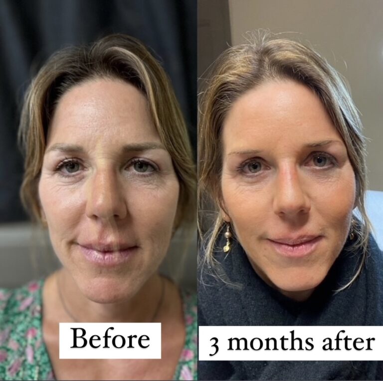 1DCD2B9A-CDDE-4812-93B7-72CA52D9A245 2